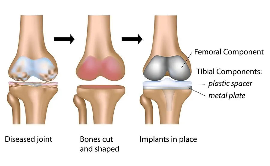 knee diagram